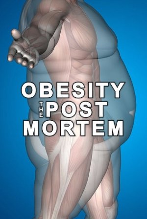 Watch Free Obesity: The Post Mortem (2016)