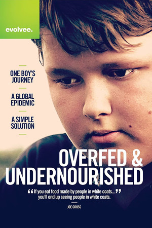 Watch Free Overfed & Undernourished (2014)