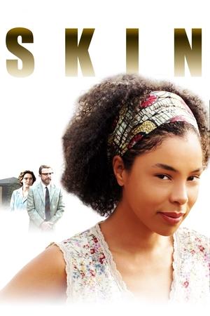Watch Free Skin (2008)