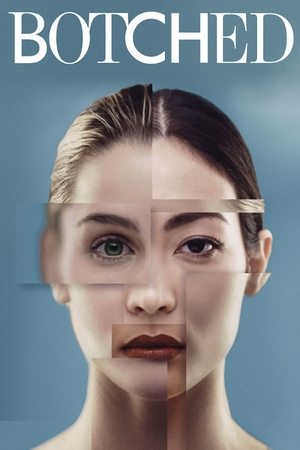 Watch Free Botched (2014 )
