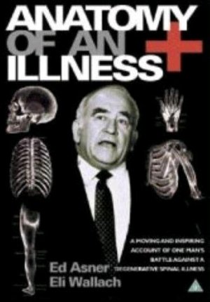 Watch Free Anatomy of an Illness (1984)