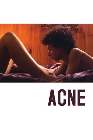 Watch Free Acné (2008)
